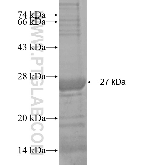 ENPP3 fusion protein Ag18892 SDS-PAGE ENPP3 fusion protein Ag18892 SDS-PAGE