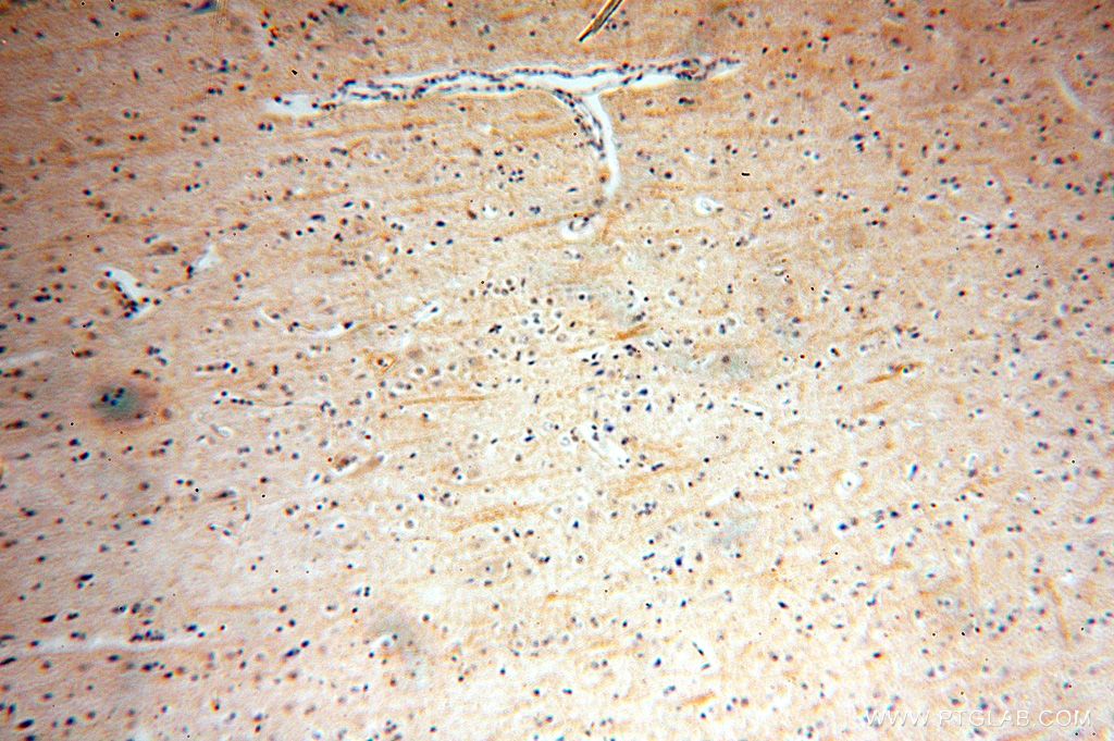 IHC staining of human brain using 17305-1-AP