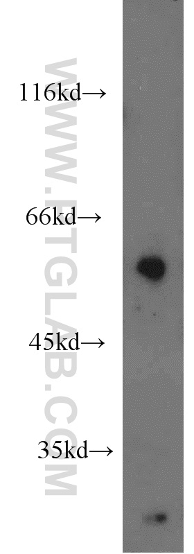 WB analysis of HL-60 using 17305-1-AP