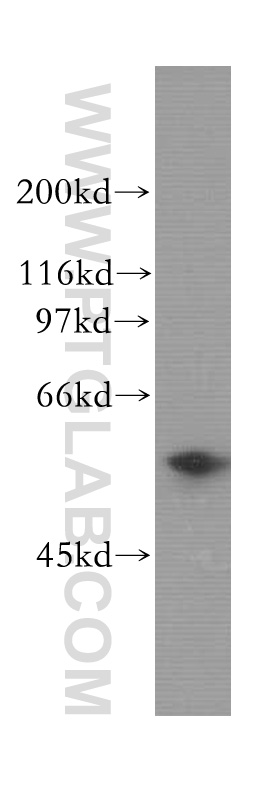 WB analysis of MCF-7 using 12778-1-AP