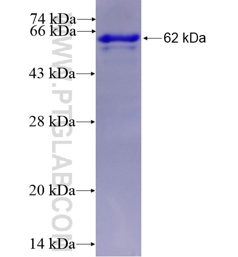 ENPP5 fusion protein Ag3478 SDS-PAGE