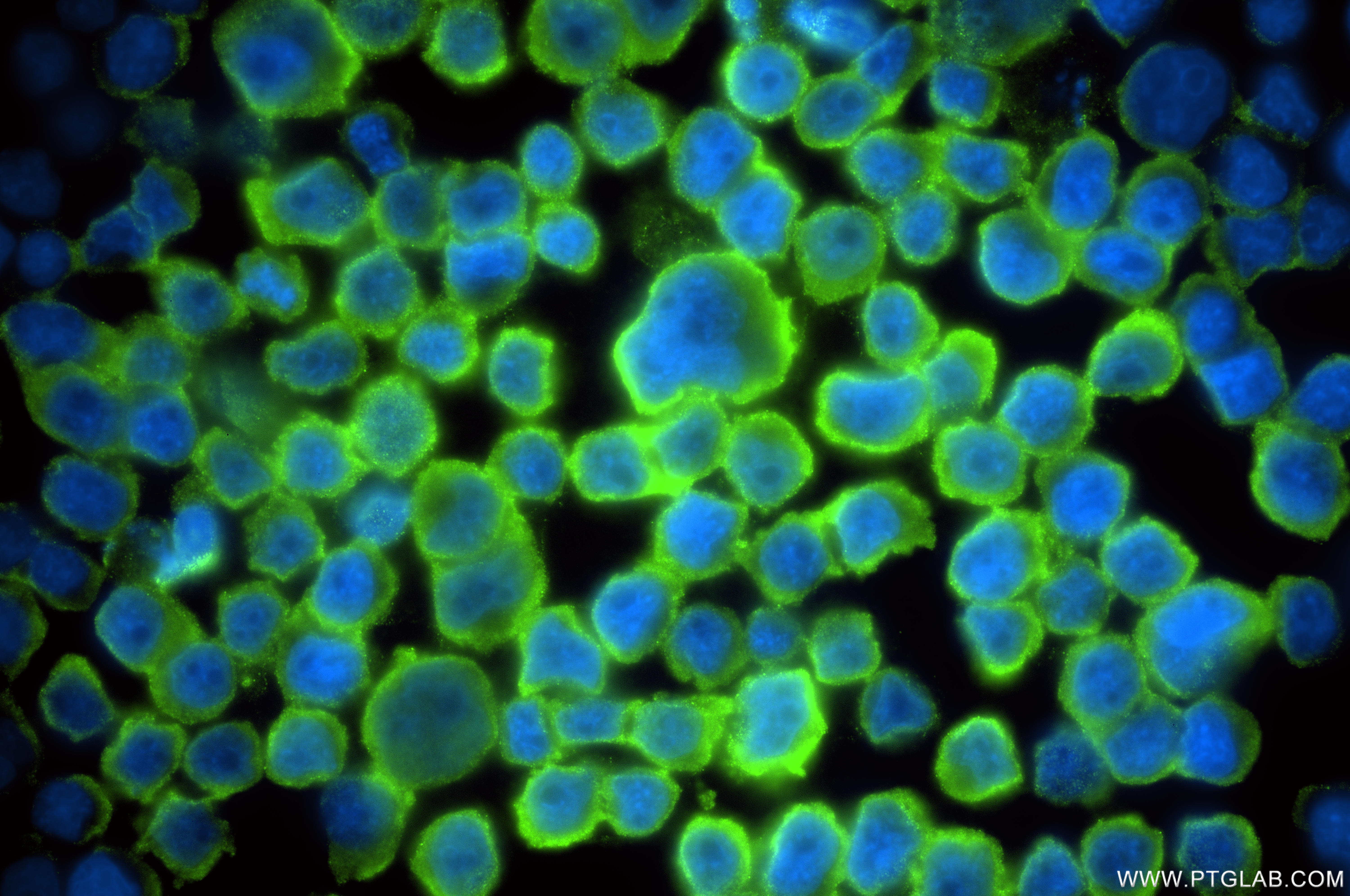 IF Staining of COLO 320 using 86820-1-RR (same clone as 86820-1-PBS) IF Staining of COLO 320 using 86820-1-RR (same clone as 86820-1-PBS)