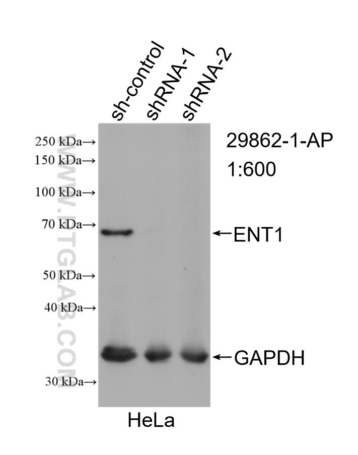 WB analysis of HeLa using 29862-1-AP