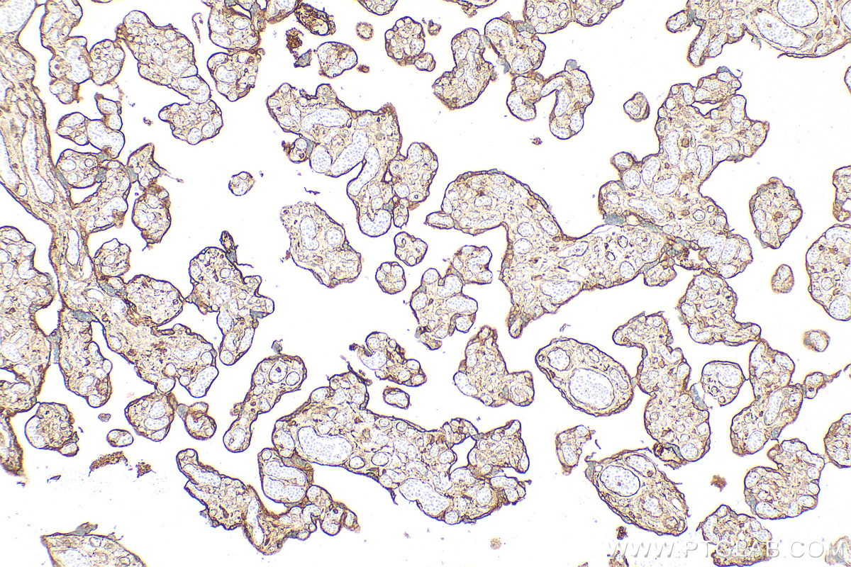IHC staining of human placenta using 14211-1-AP IHC staining of human placenta using 14211-1-AP