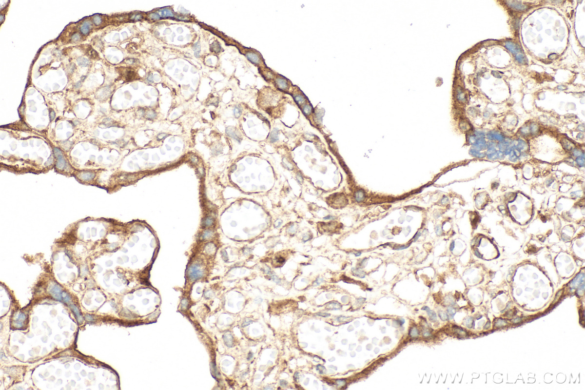 IHC staining of human placenta using 14211-1-AP IHC staining of human placenta using 14211-1-AP