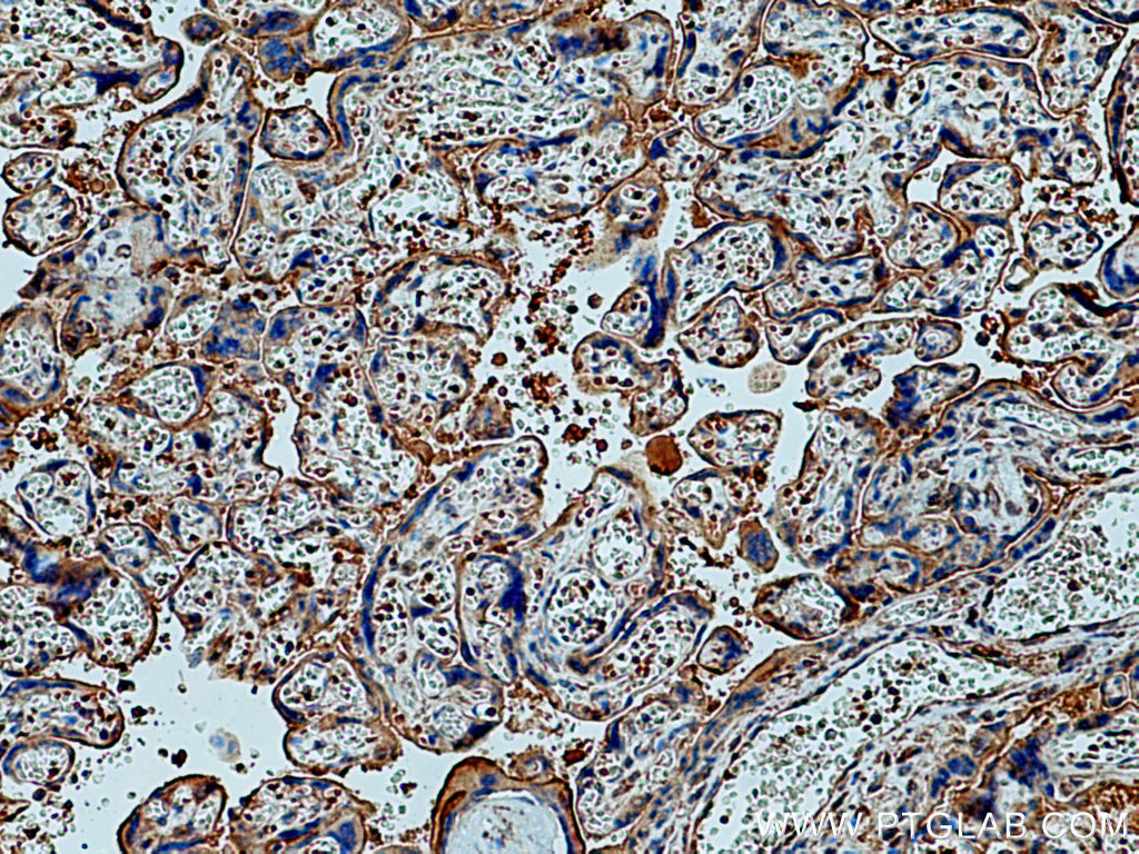 IHC staining of human placenta using 60323-1-Ig (same clone as 60323-1-PBS)