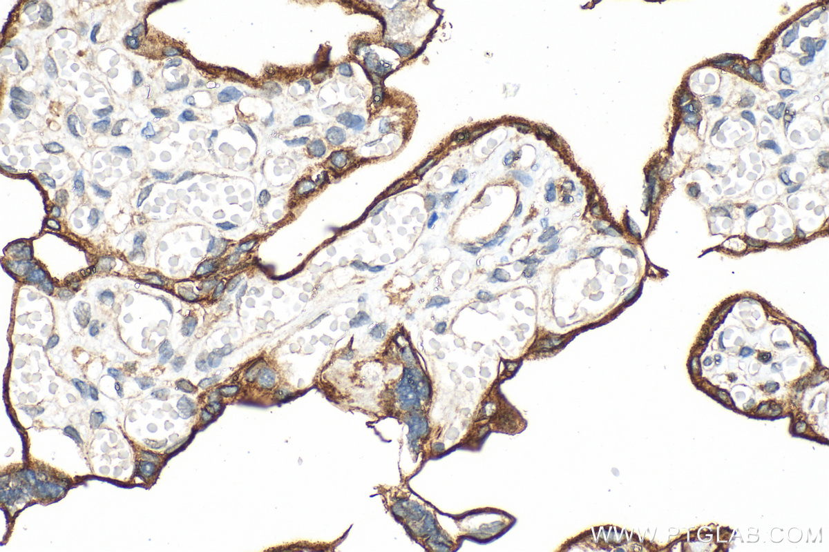 IHC staining of human placenta using 60323-1-Ig