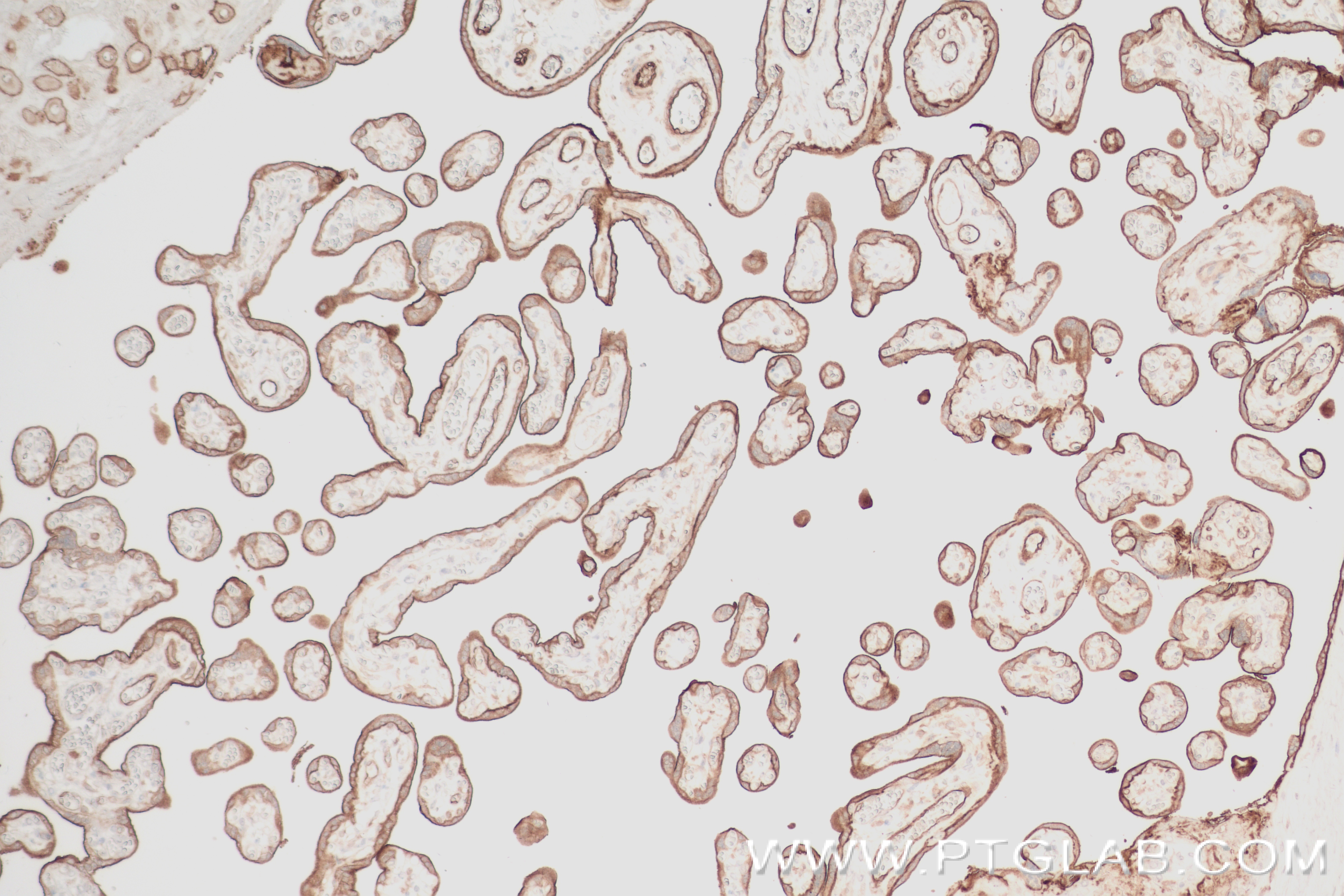 IHC staining of human placenta using 84235-4-RR