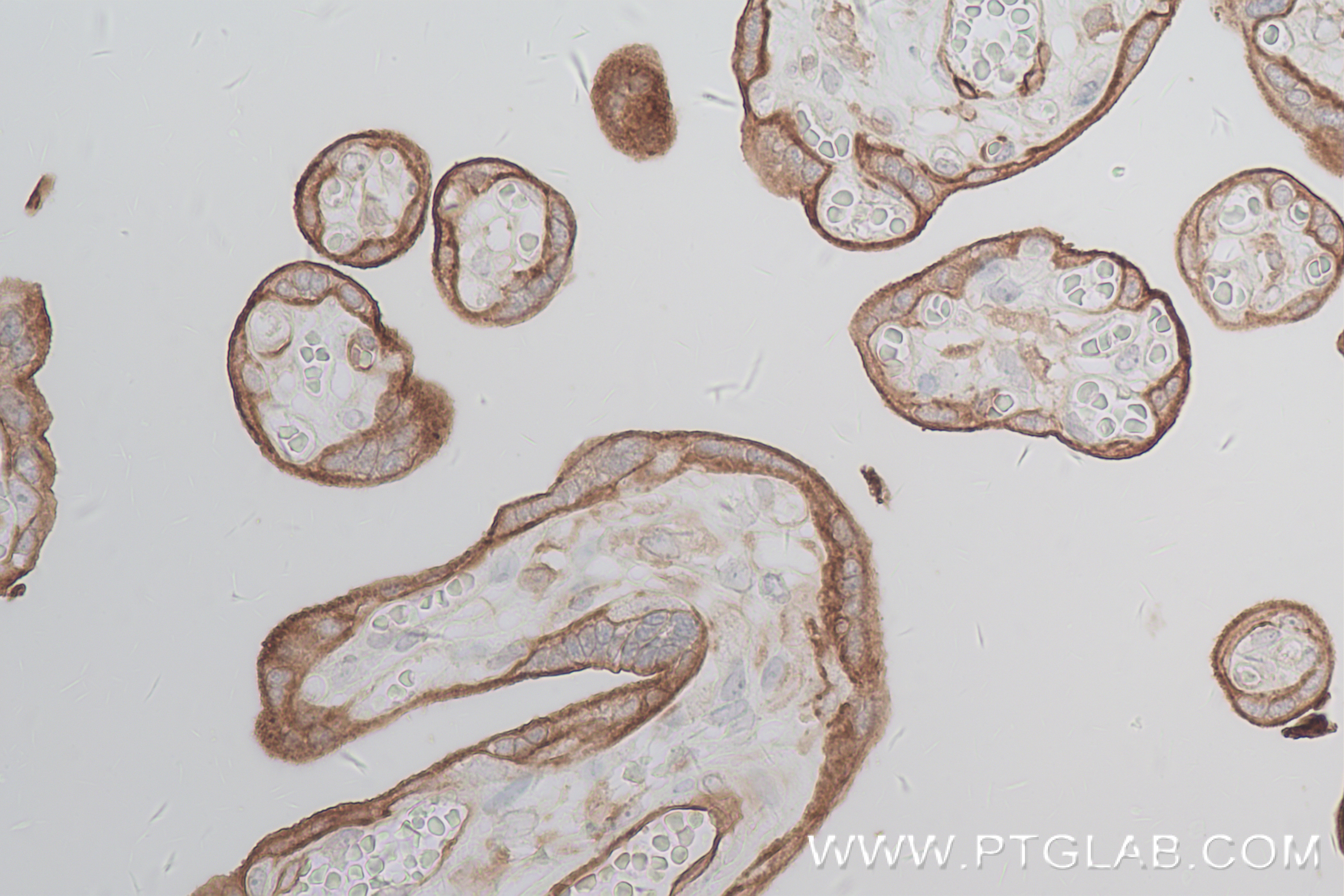 IHC staining of human placenta using 84235-4-RR