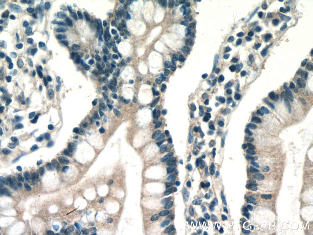 IHC staining of human small intestine using 13656-1-AP