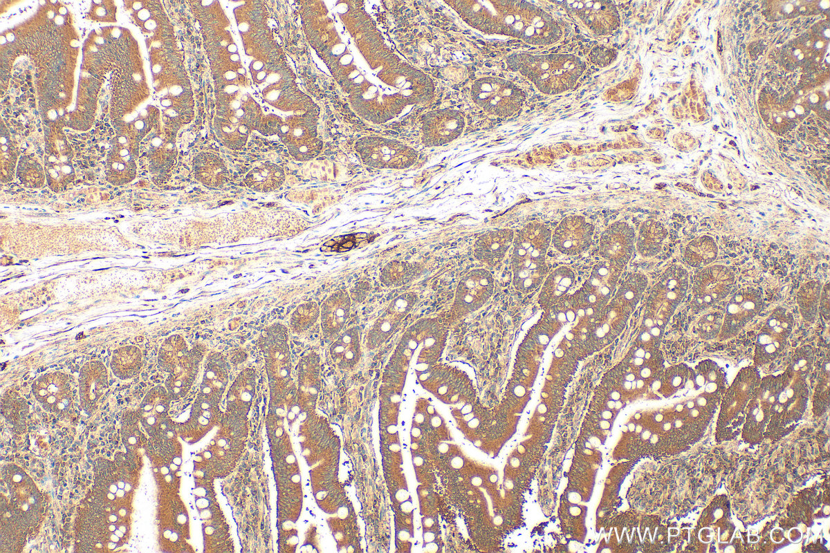 IHC staining of human small intestine using 13656-1-AP