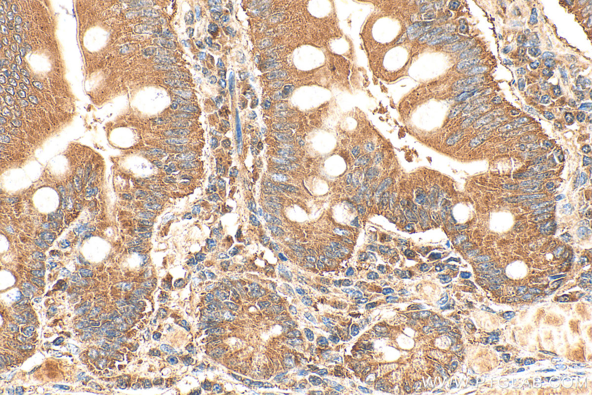 IHC staining of human small intestine using 13656-1-AP