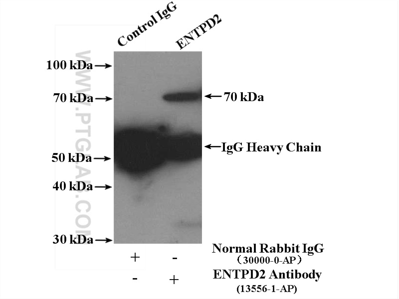 IP experiment of K-562 using 13656-1-AP