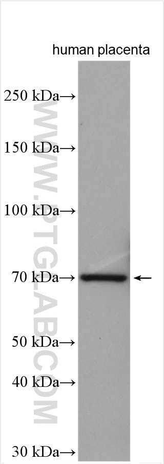 WB analysis of human placenta using 13656-1-AP