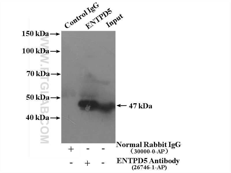 IP experiment of mouse liver using 26746-1-AP