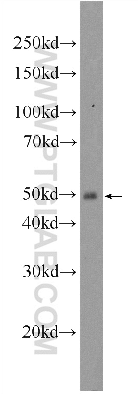 WB analysis of mouse spleen using 11626-1-AP