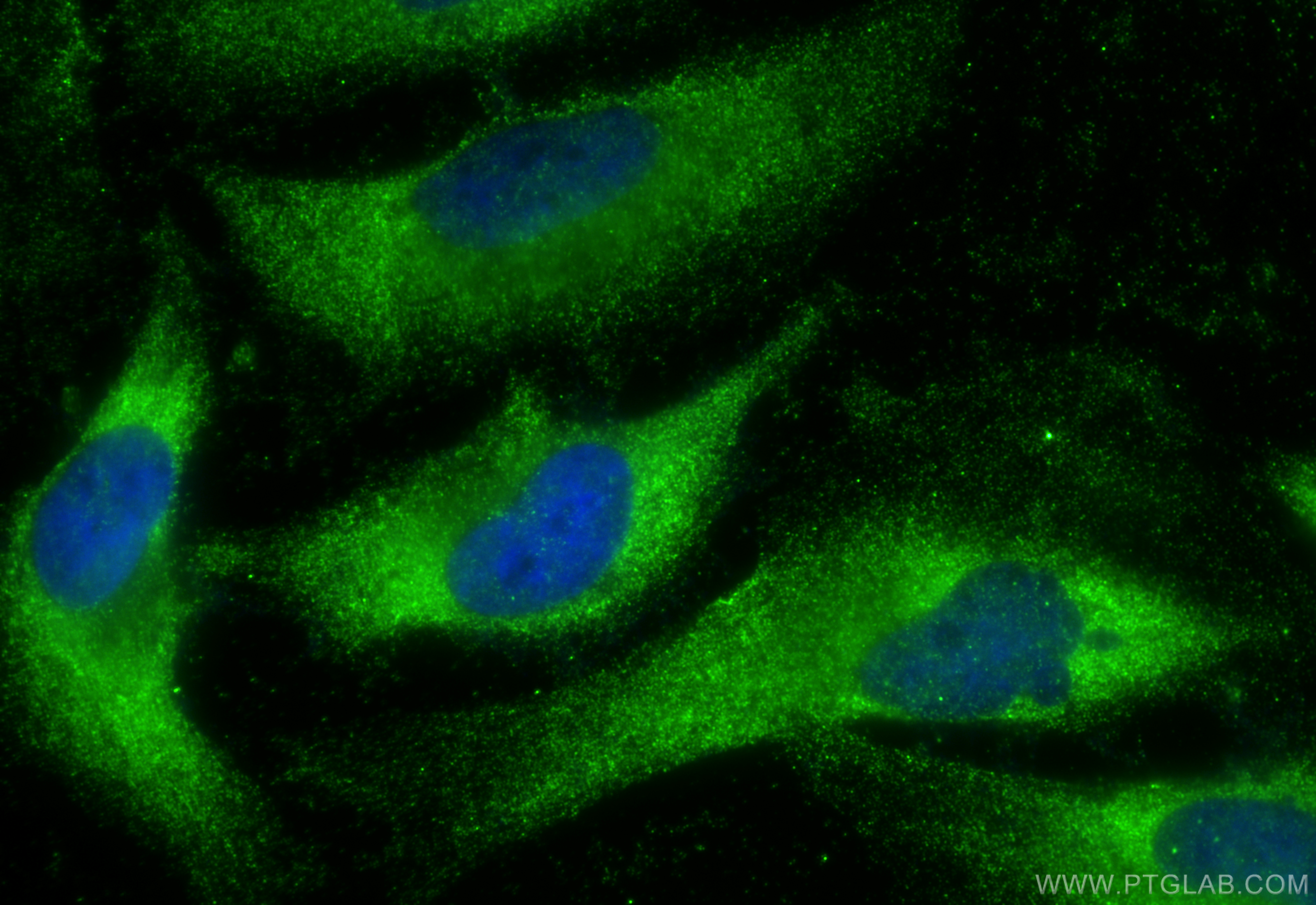 IF Staining of HeLa using 24558-1-AP