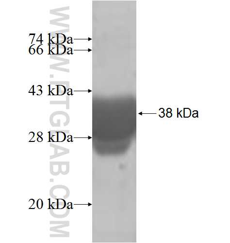 ENY2 fusion protein Ag8462 SDS-PAGE