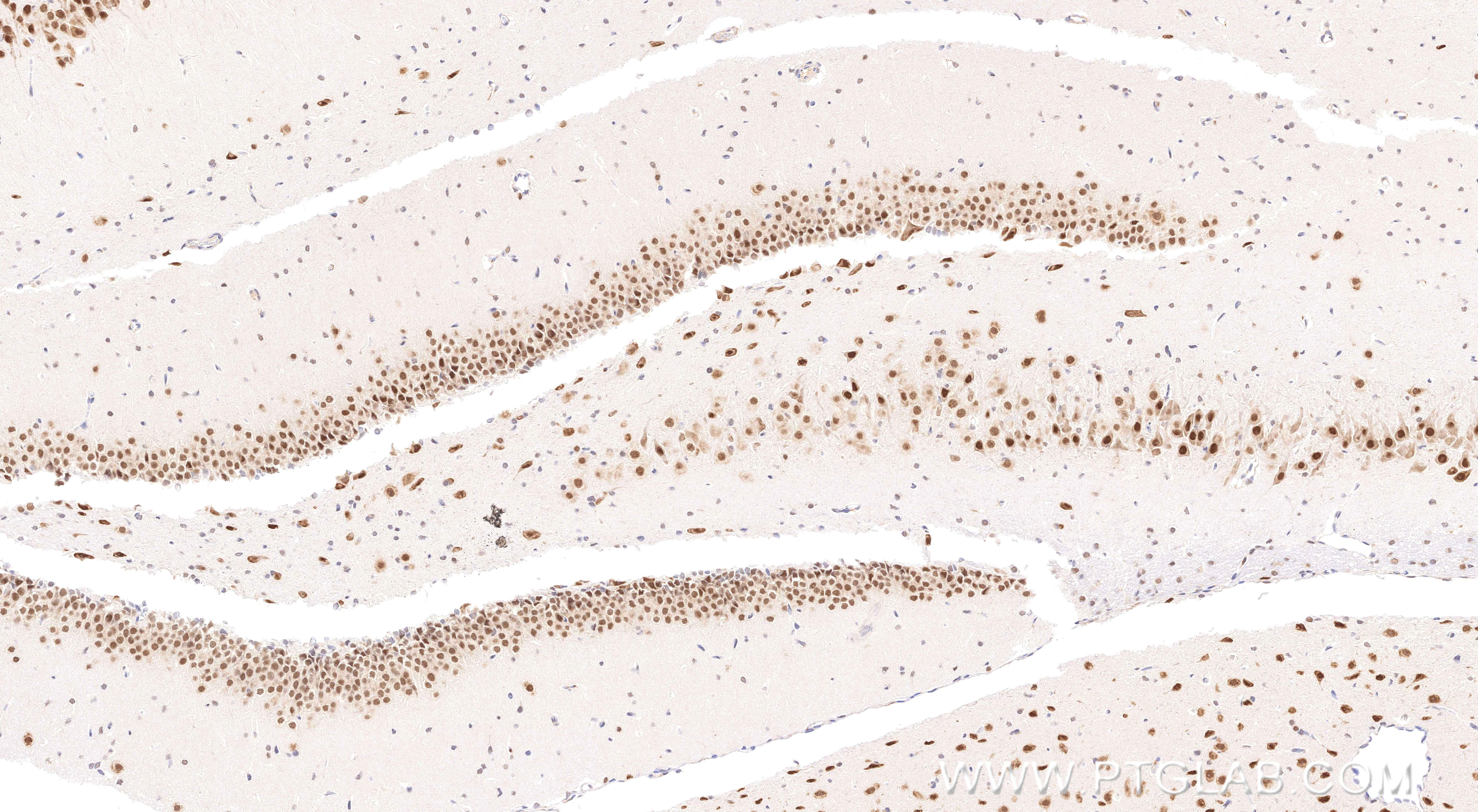 IHC staining of rat brain using 83945-5-PBS