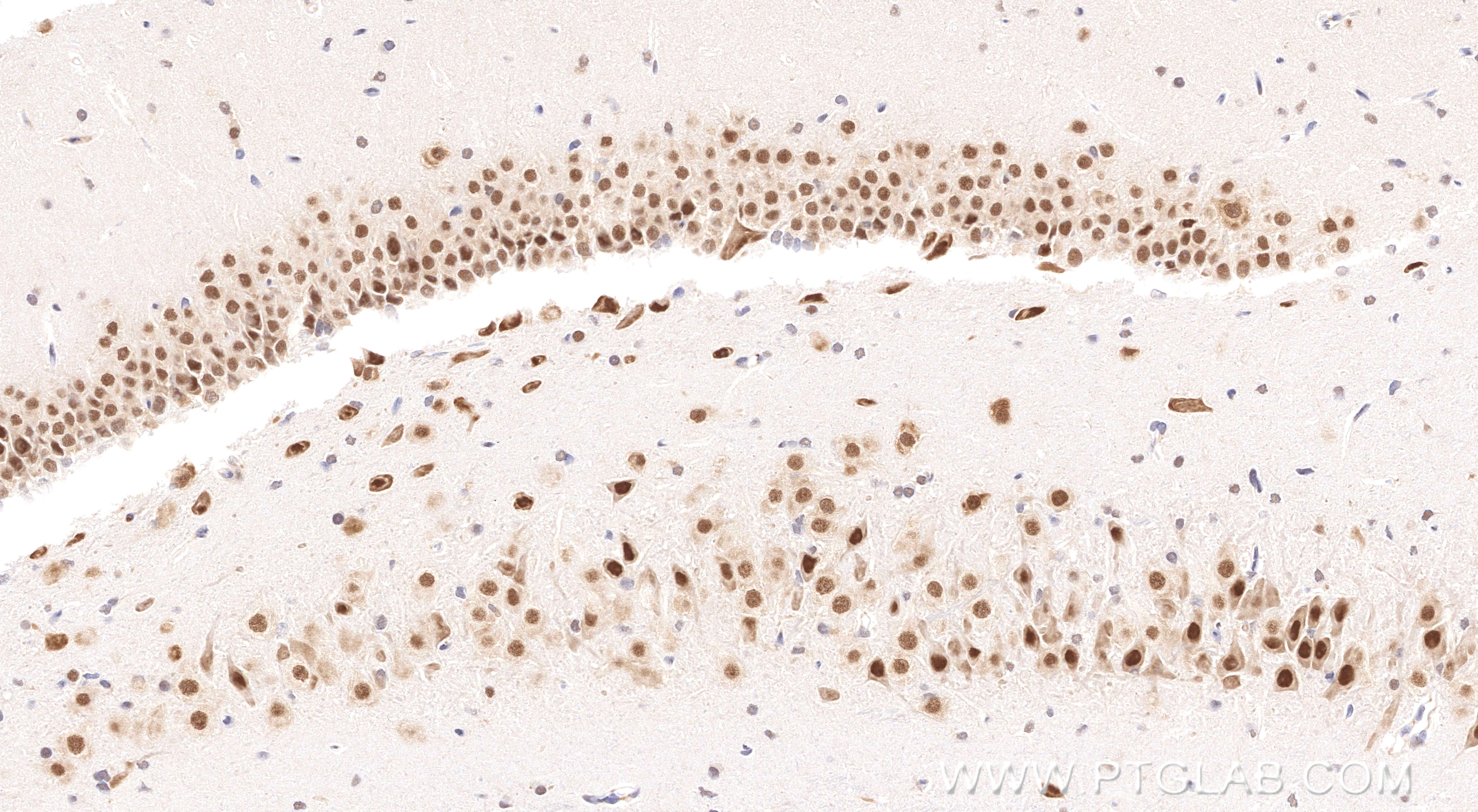 IHC staining of rat brain using 83945-5-PBS