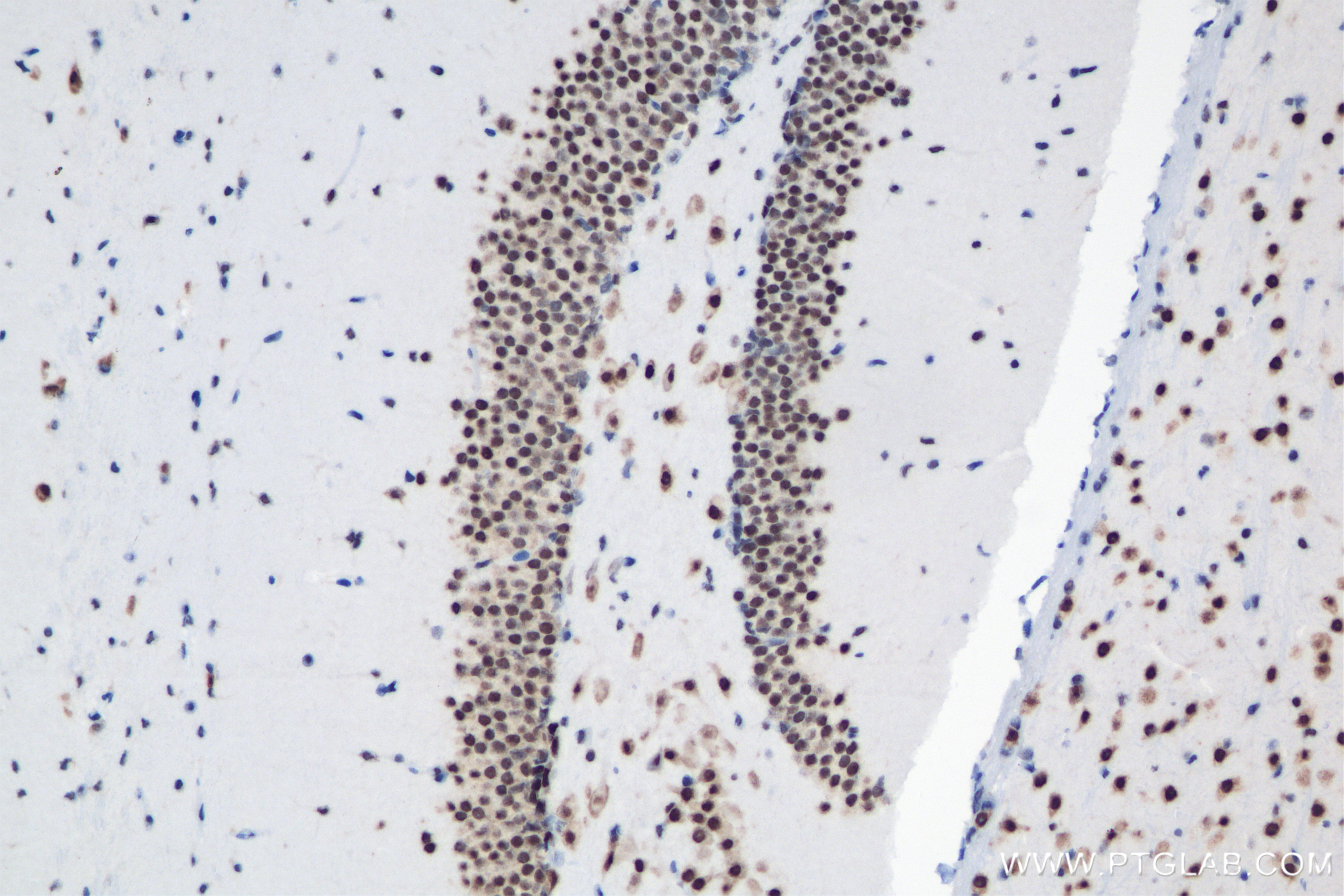 IHC staining of mouse brain using 83945-5-RR