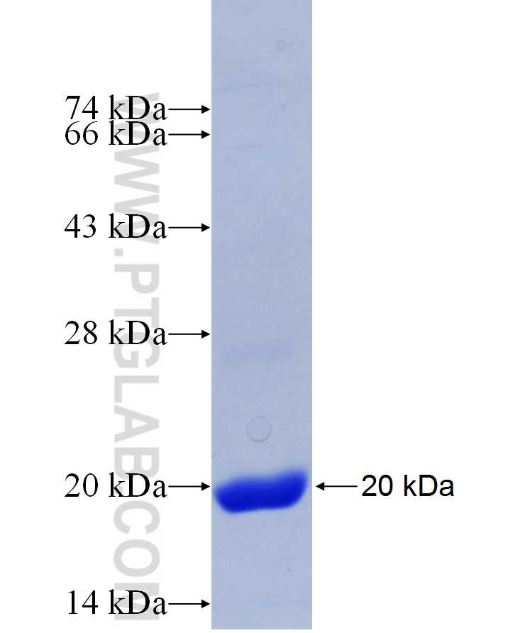 EOMES fusion protein Ag29939 SDS-PAGE EOMES fusion protein Ag29939 SDS-PAGE