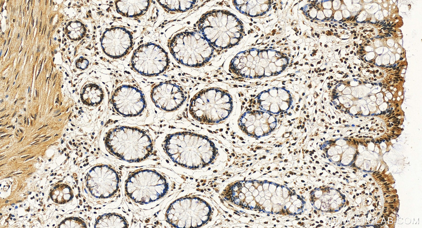 IHC staining of human colon using 13858-1-AP