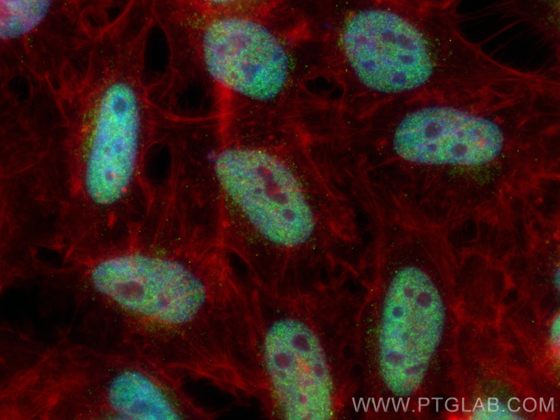 IF Staining of HeLa using 13858-1-AP