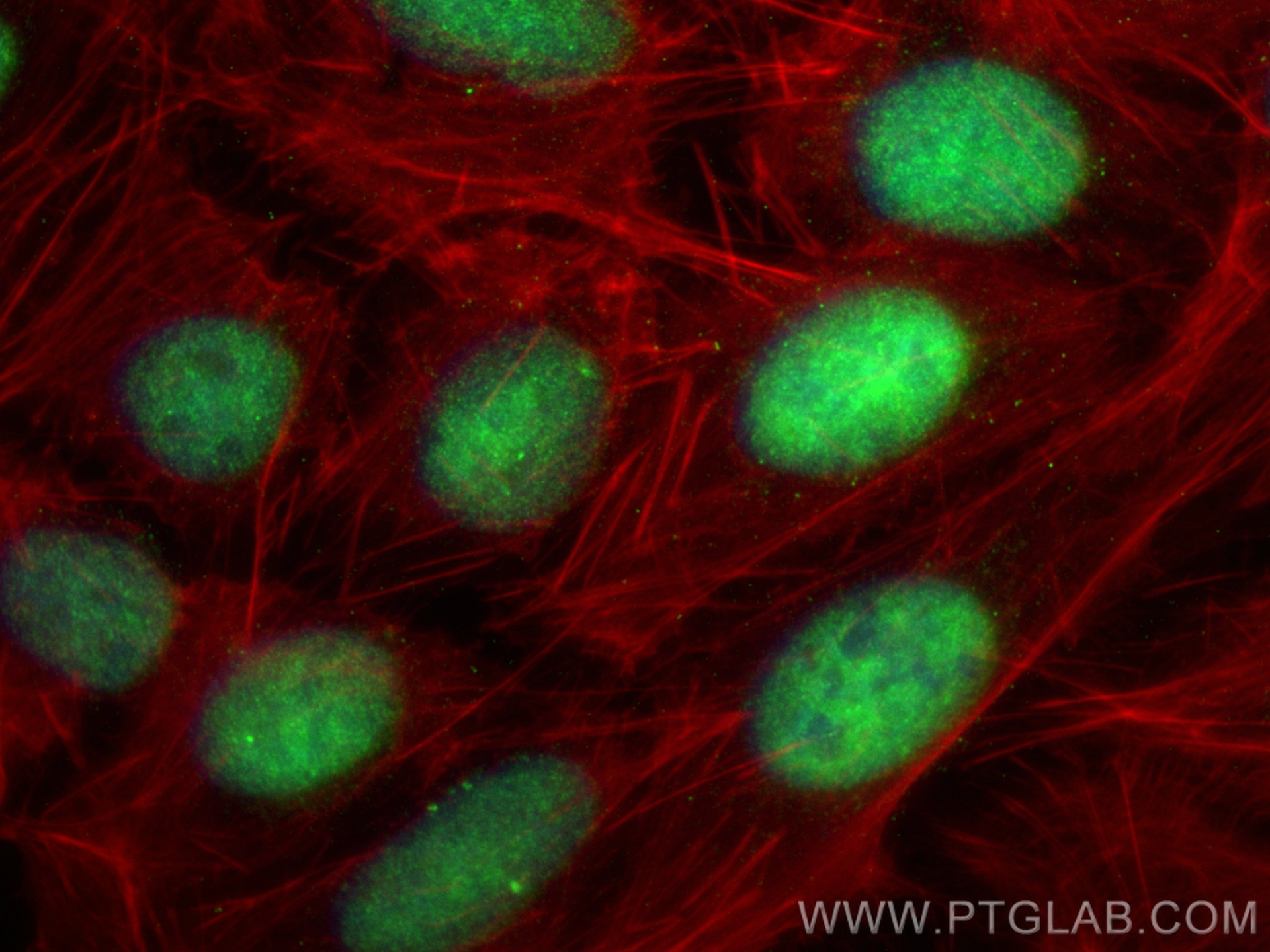 IF Staining of U2OS using 13858-1-AP
