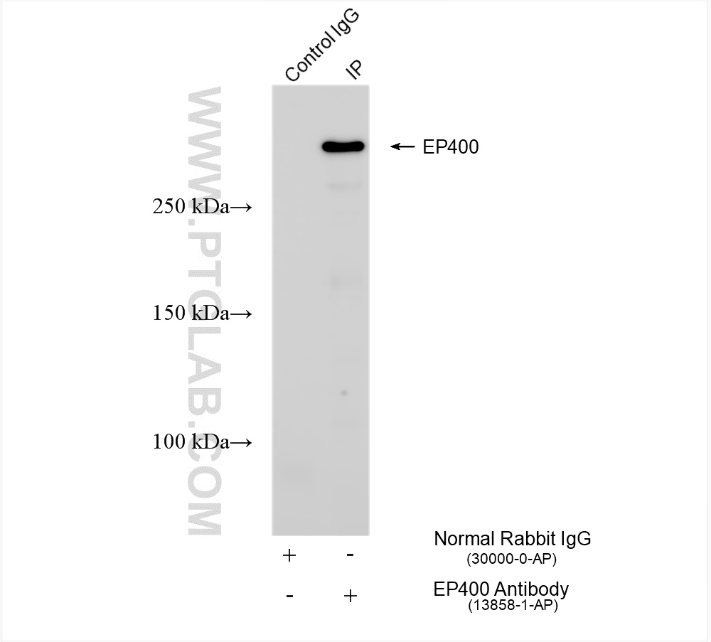 IP experiment of HEK-293 using 13858-1-AP