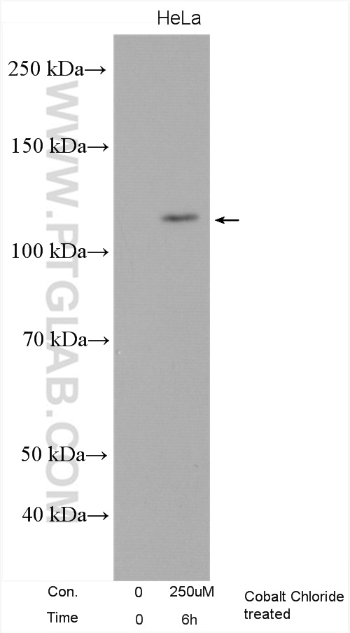 HIF2α/EPAS1