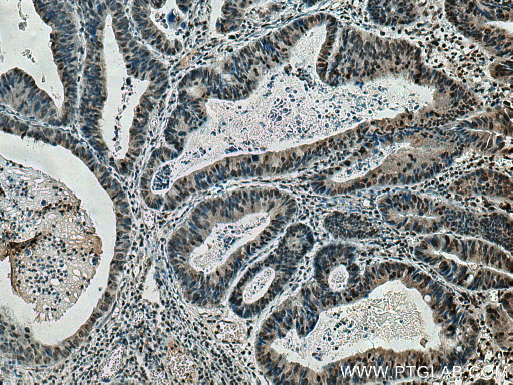 HIF2α/EPAS1