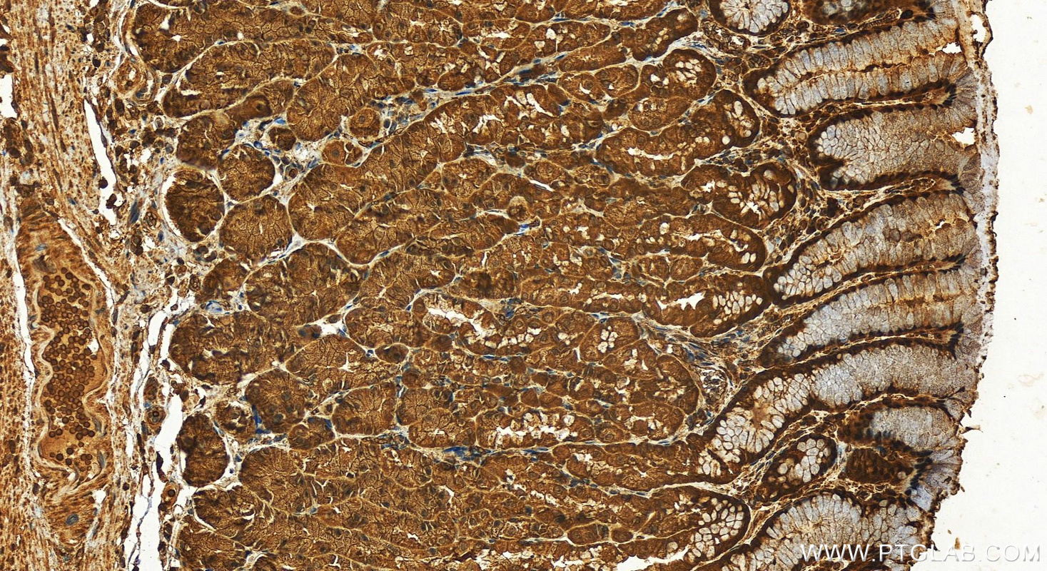 IHC staining of human stomach using 13014-1-AP