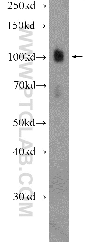 WB analysis of mouse brain using 13440-1-AP