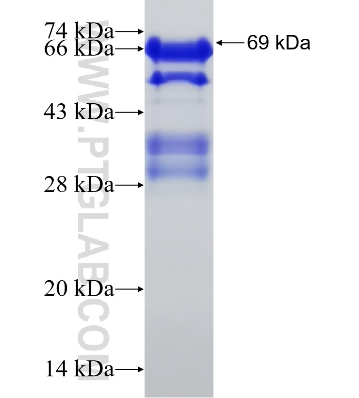 EPB41L1 fusion protein Ag4250 SDS-PAGE