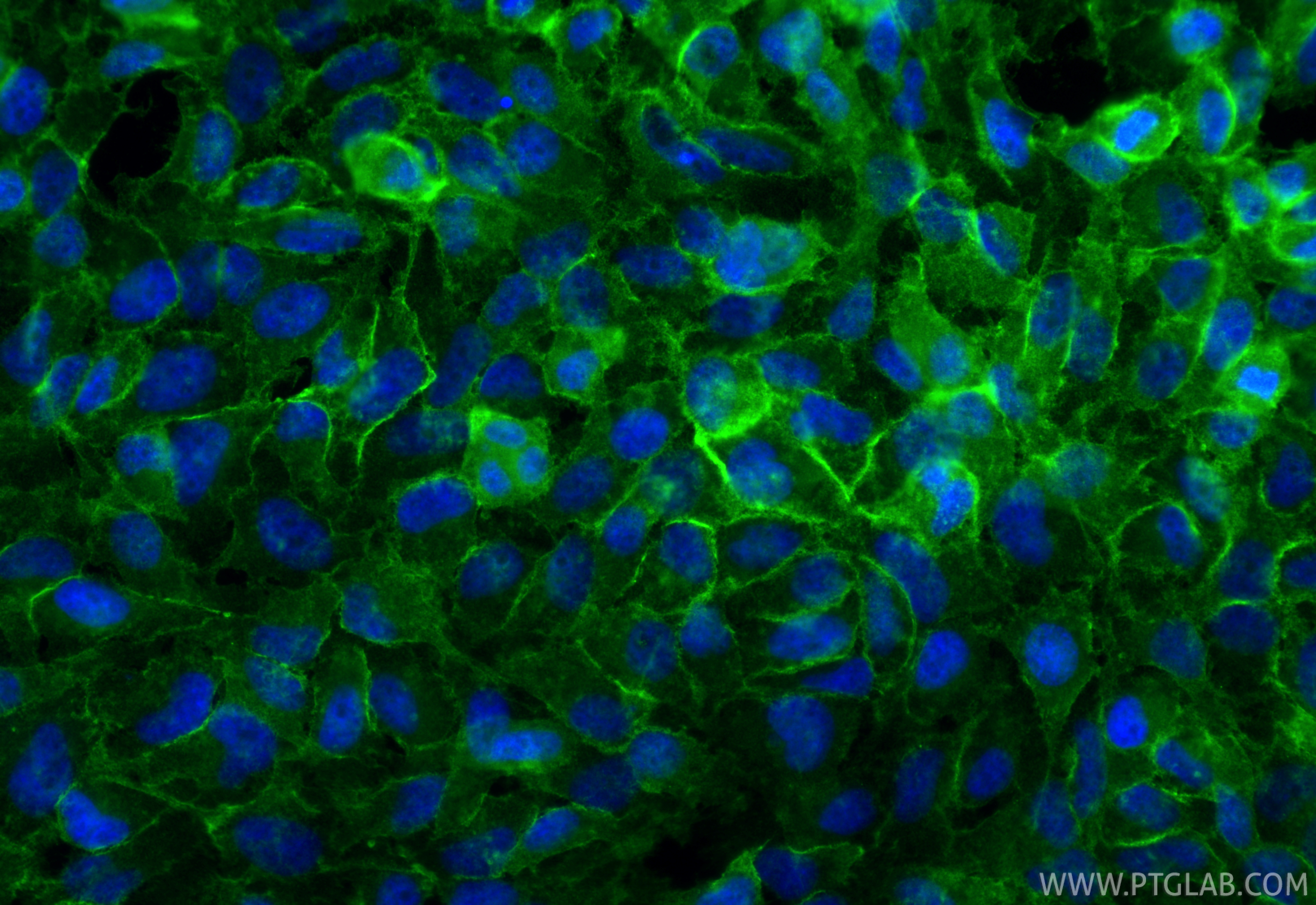 Immunofluorescent analysis of (4% PFA) fixed HeLa cells using EPB41L2 antibody (15437-1-AP) at dilution of 1:200 and CoraLite®488-Conjugated Goat Anti-Rabbit IgG(H+L) (<a class='green' href='/productredirect?CatalogNo=SA00013-2' target='_blank'>SA00013-2</a>). IF Staining of HeLa using 15437-1-AP