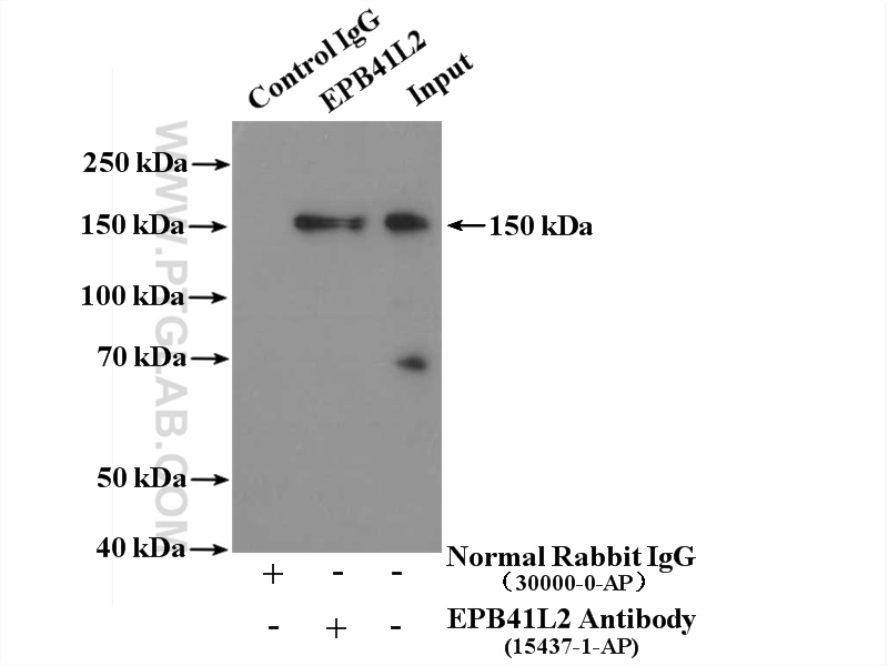 IP experiment of HEK-293 using 15437-1-AP