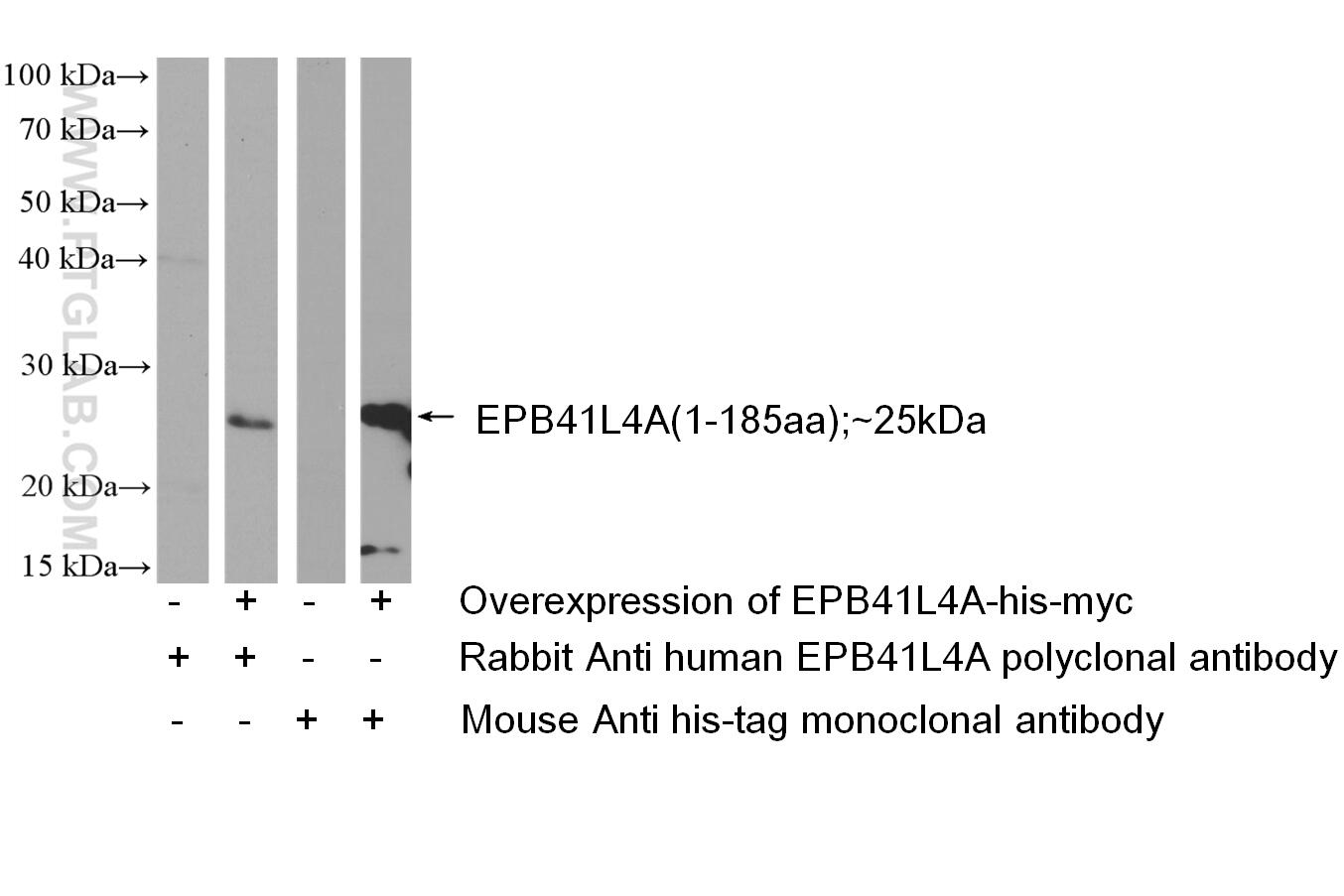 WB analysis of Transfected HEK-293 using 26596-1-AP