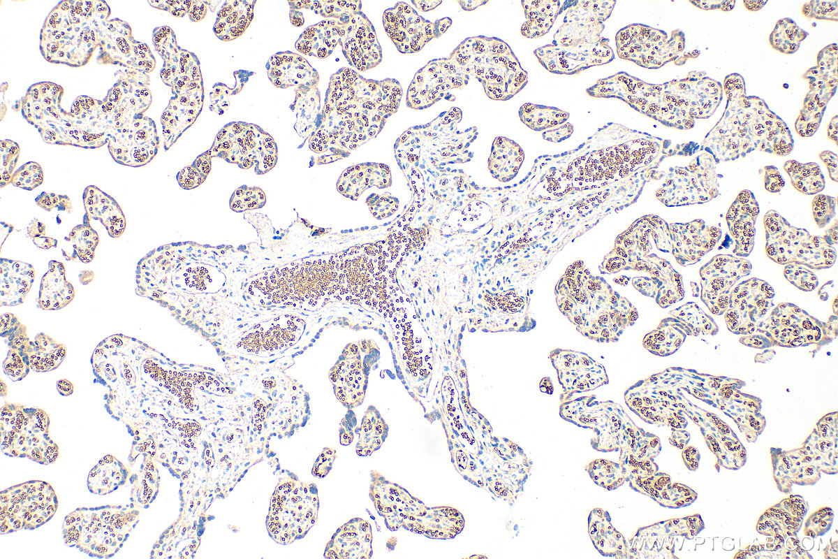 IHC staining of human placenta using 27443-1-AP