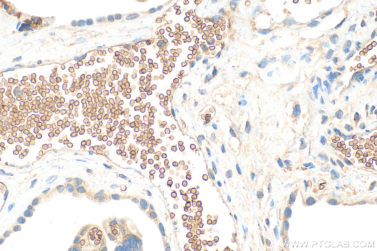 IHC staining of human placenta using 27443-1-AP