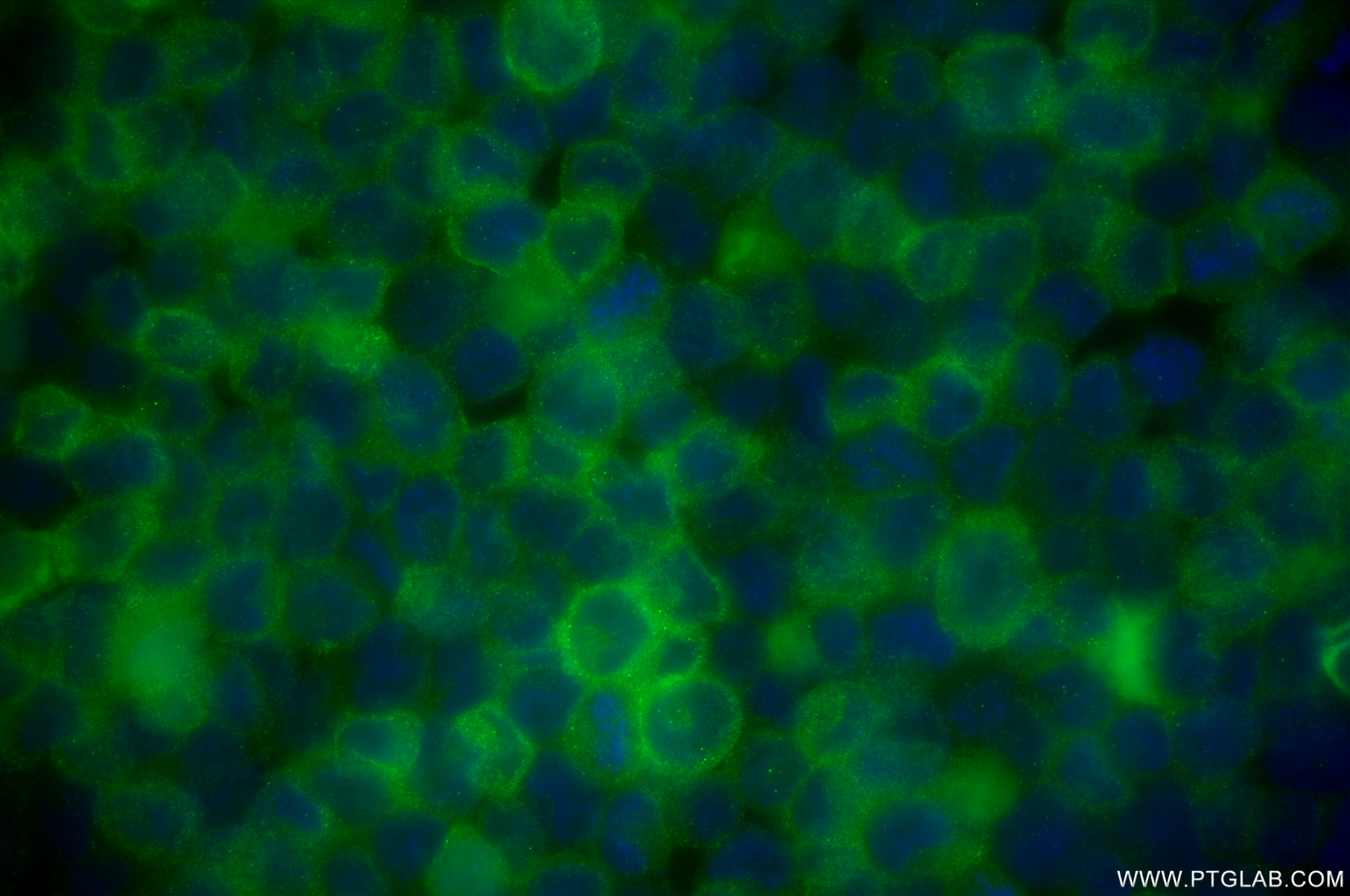 IF Staining of HEL using 84921-3-RR (same clone as 84921-3-PBS)
