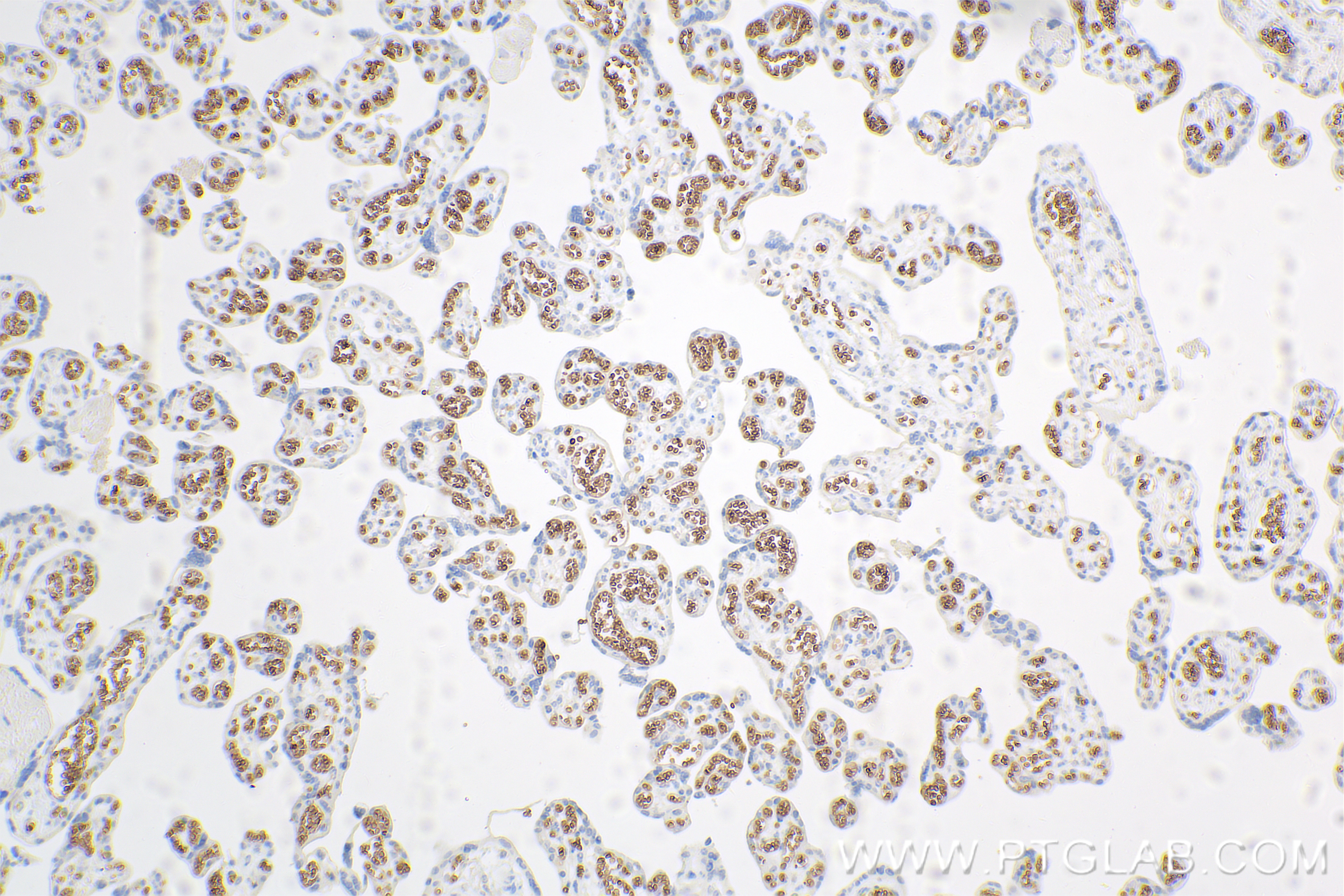 IHC staining of human placenta using 84921-3-RR (same clone as 84921-3-PBS)