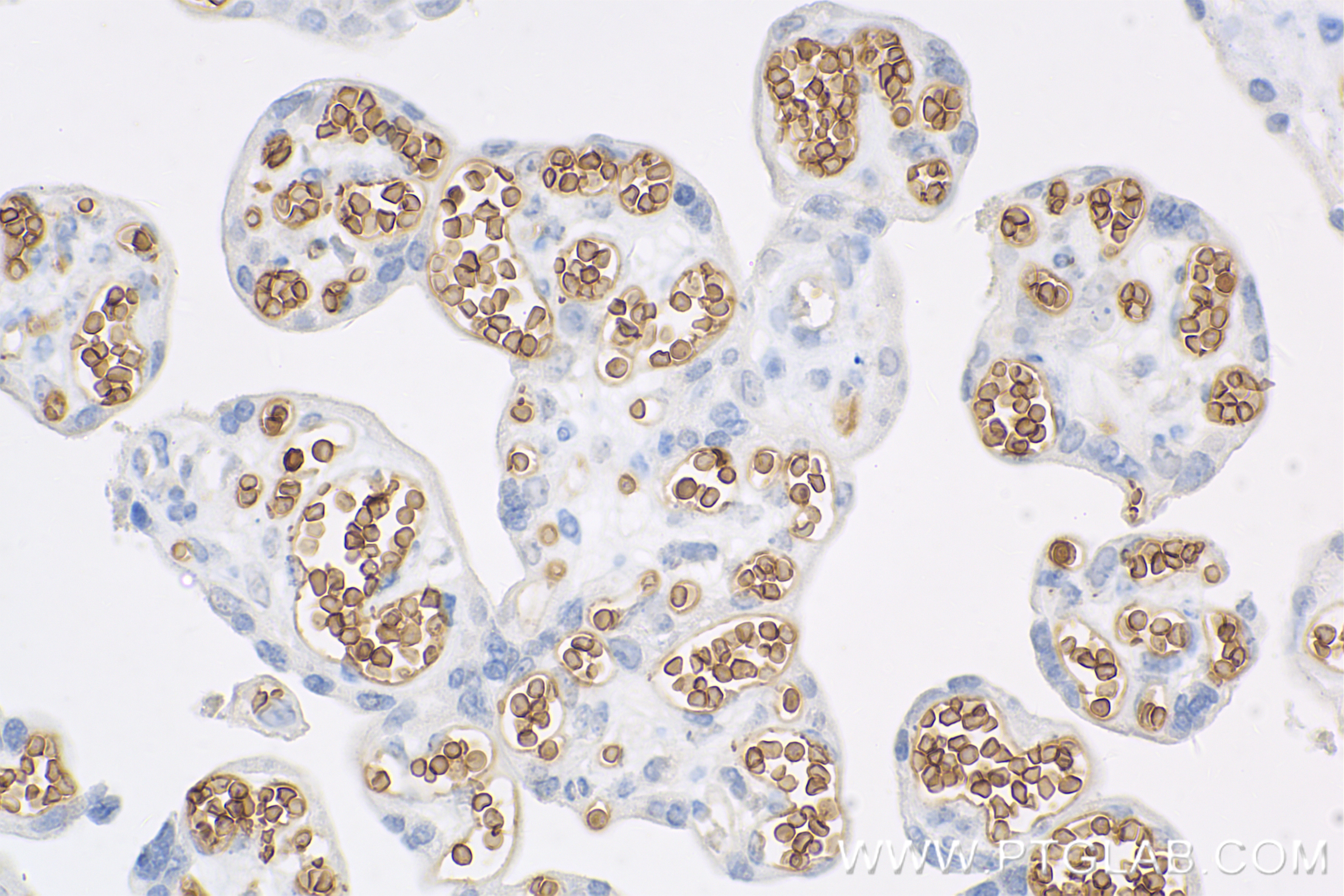 IHC staining of human placenta using 84921-3-RR (same clone as 84921-3-PBS)