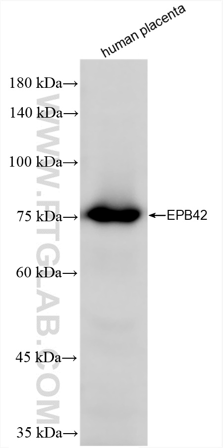 WB analysis of human placenta using 84921-3-RR (same clone as 84921-3-PBS)
