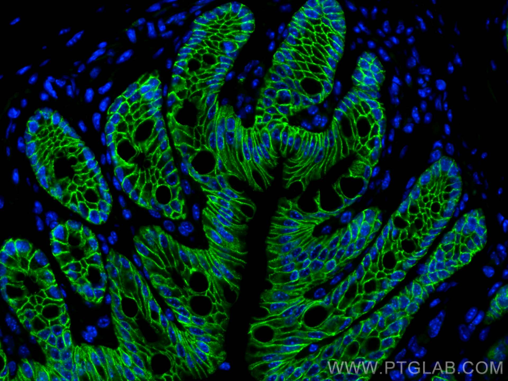 IF Staining of mouse colon using 21050-1-AP