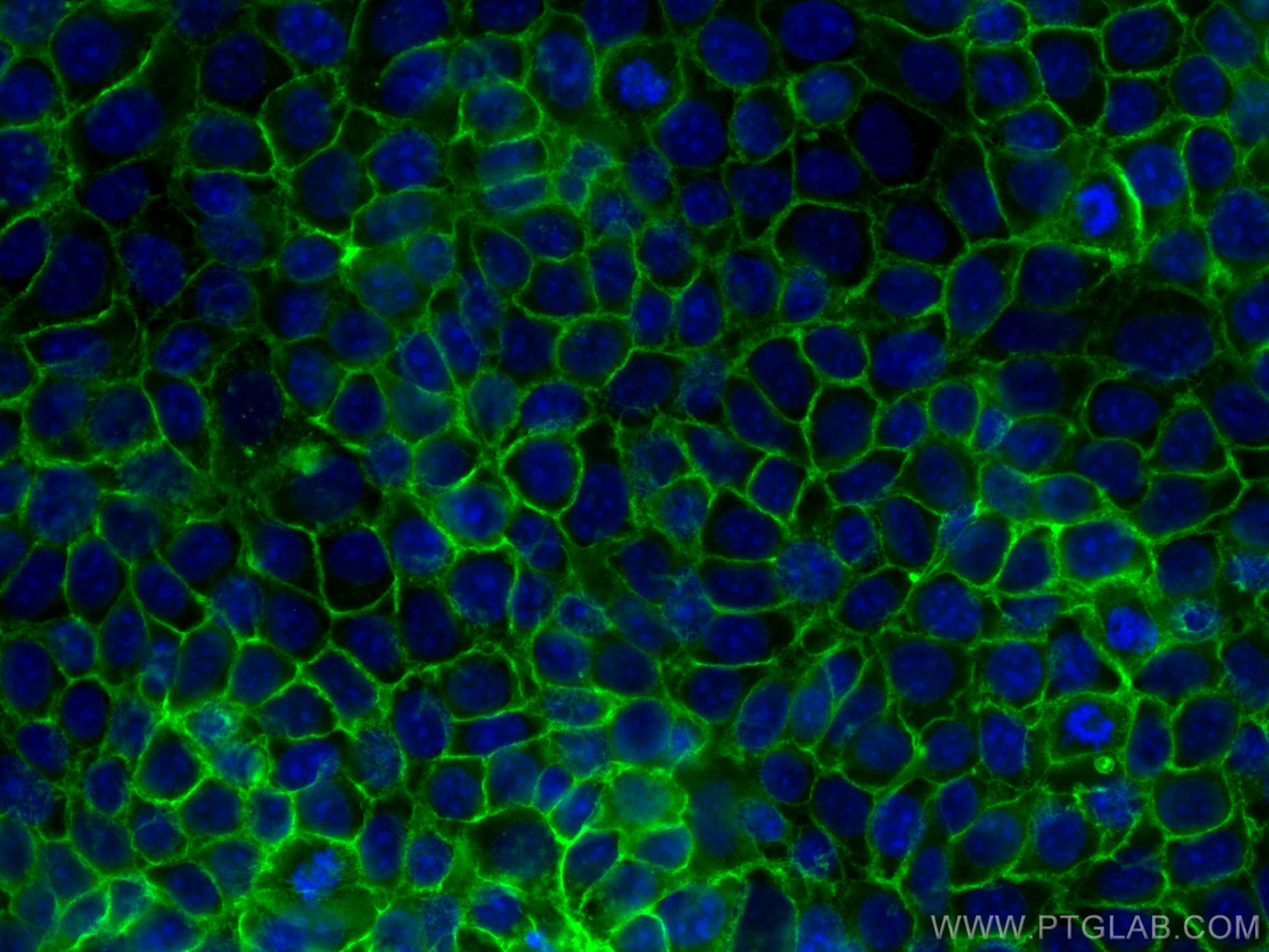 IF Staining of MCF-7 using 66316-1-Ig (same clone as 66316-1-PBS)