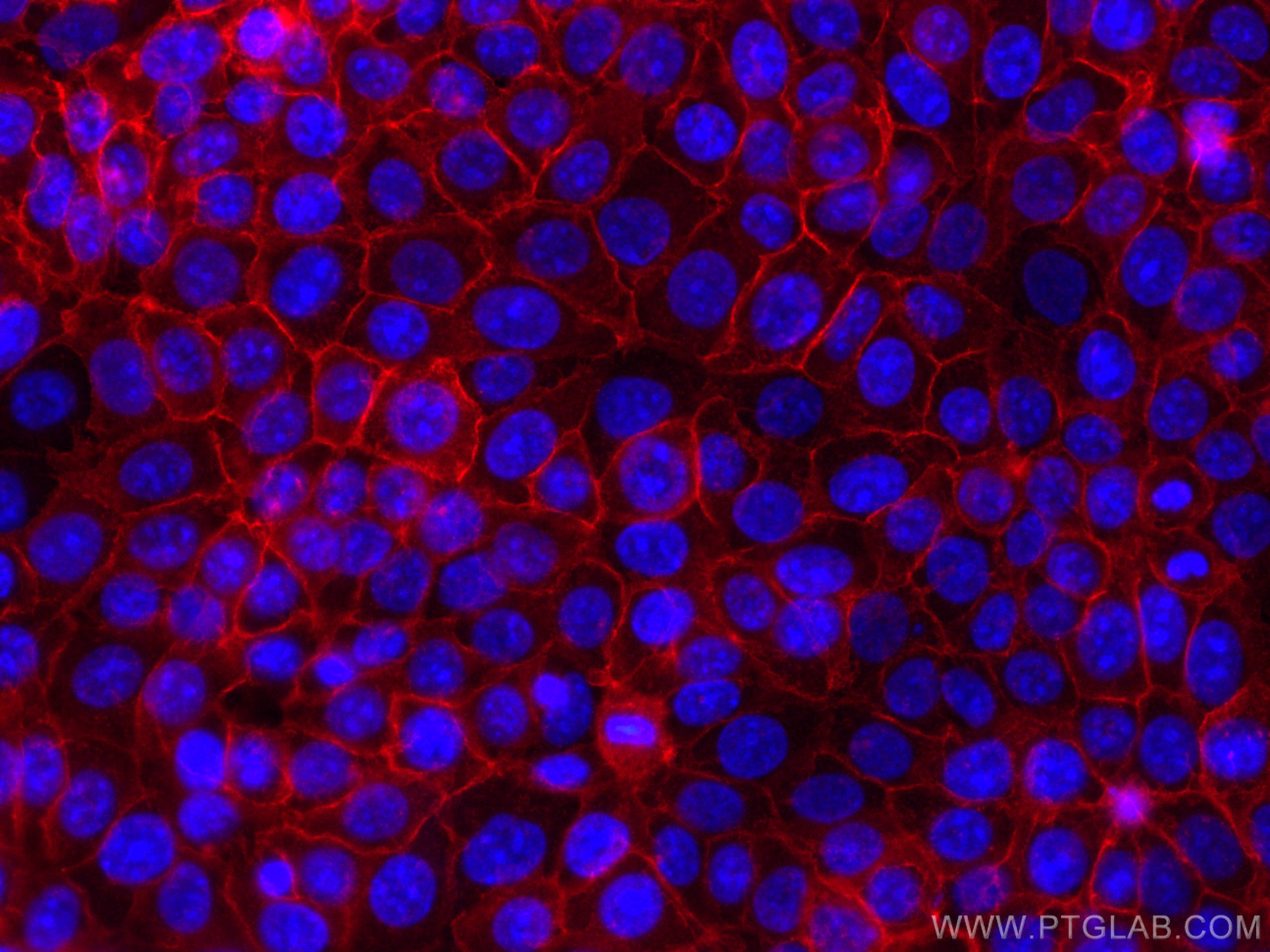 IF Staining of MCF-7 using CL594-66316