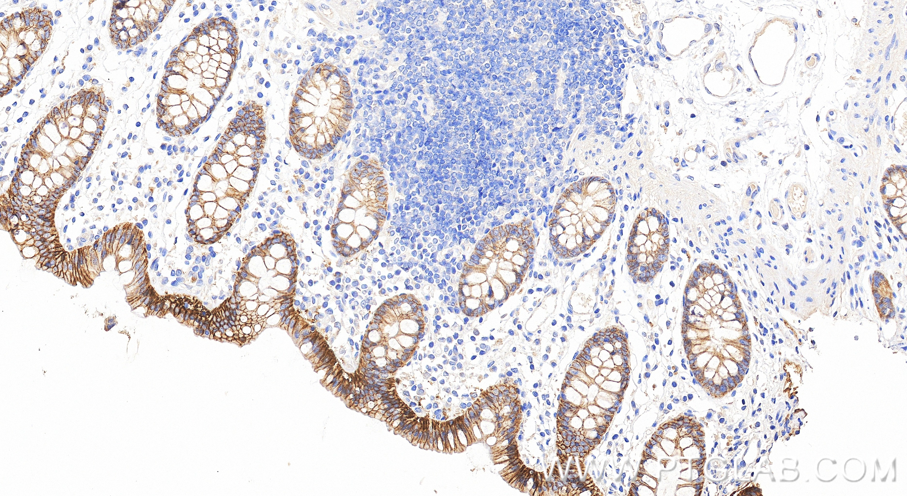 IHC staining of human colon using 84073-11-RR