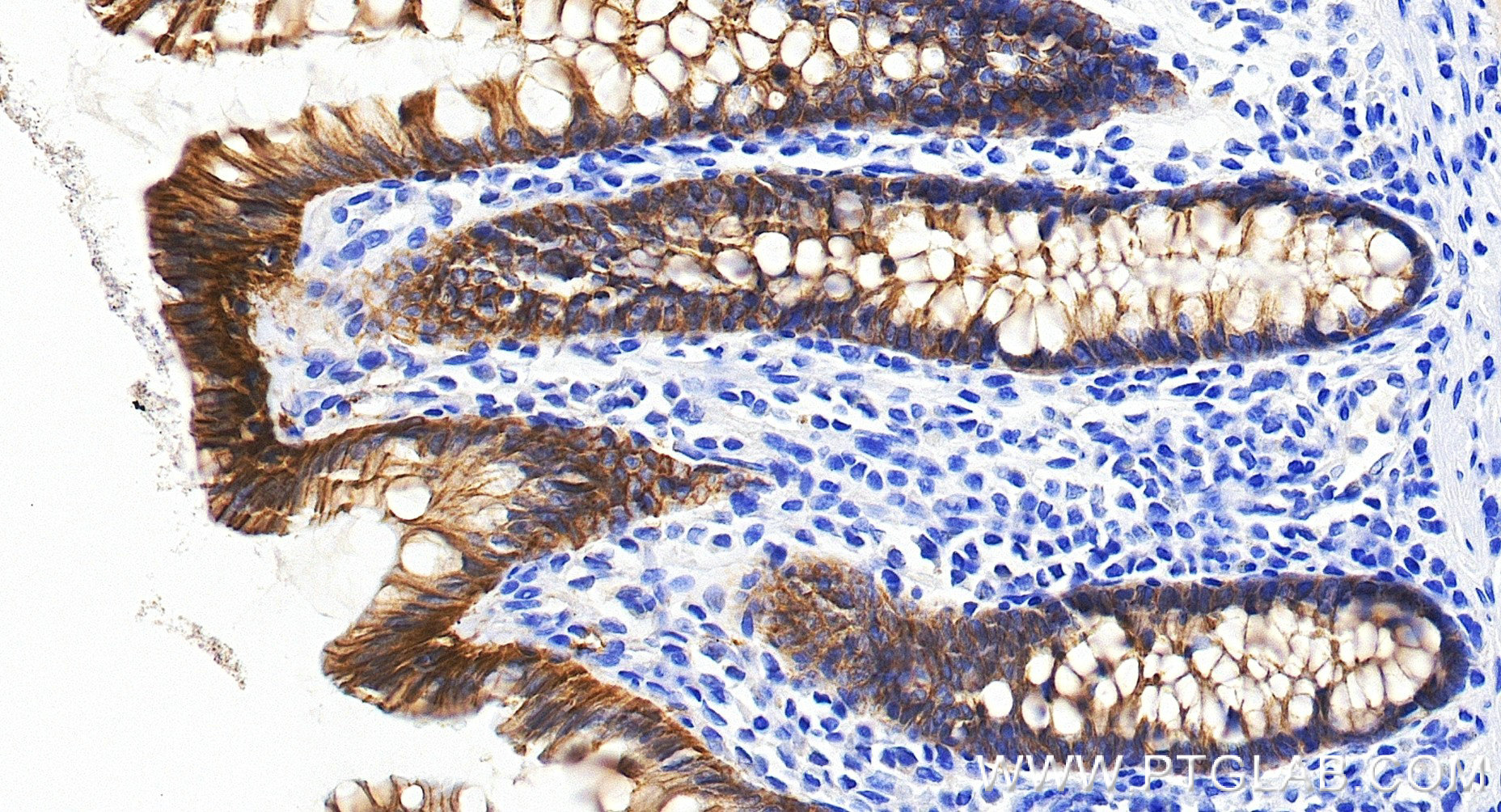 IHC staining of human colon using 84073-11-RR