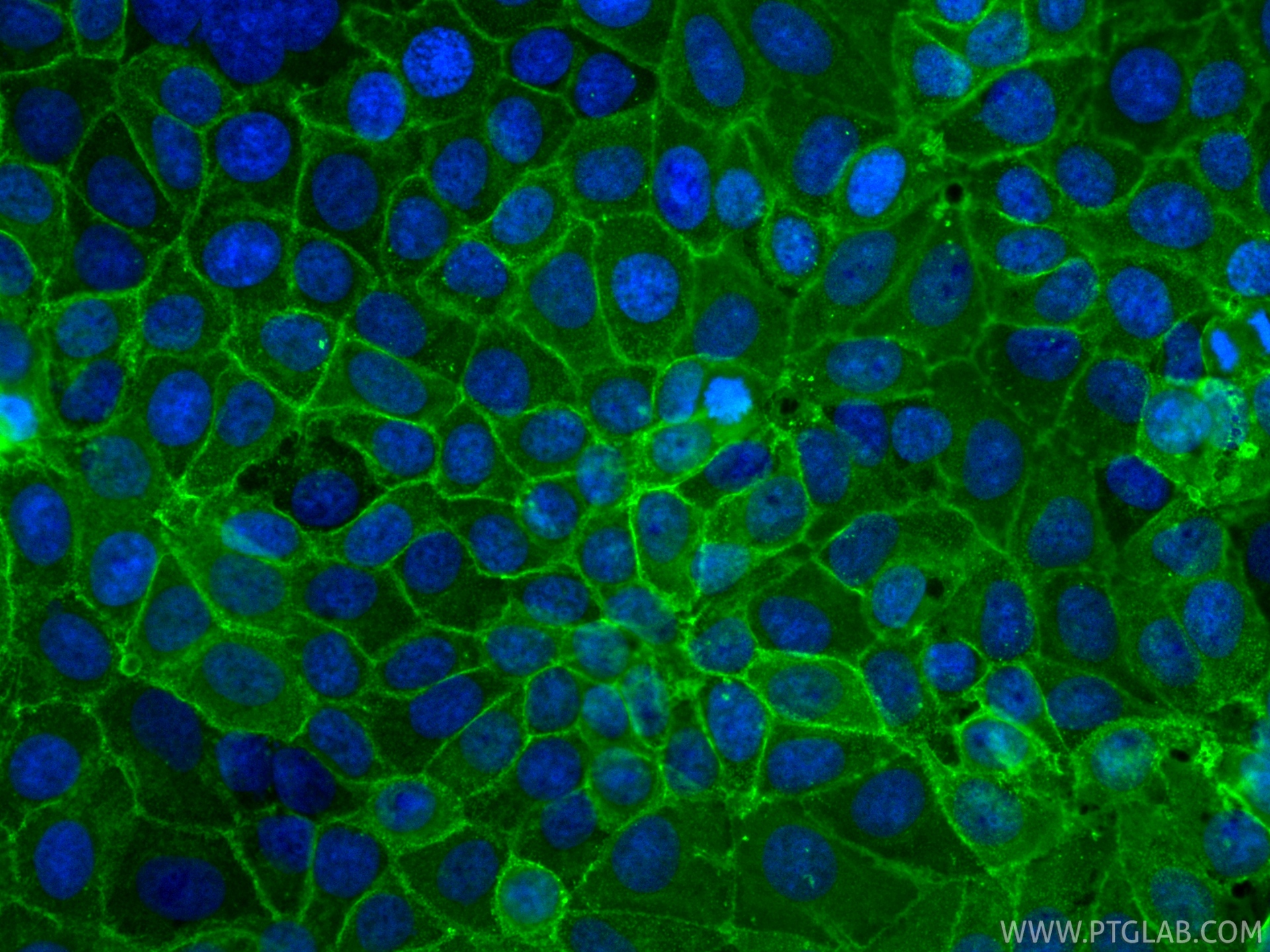 IF Staining of MCF-7 using 84073-11-RR
